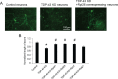 Figure 1. Rescue of axon outgrowth deficit in TDP-43-knockdown neurons by Rp overexpression.